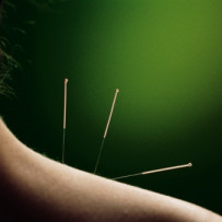 WHAT IS FIBROMYALGIA SYNDROME?