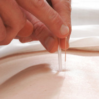 Easy Health and Living: 3 ways to treat muscle cramps