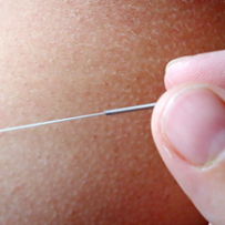 CHINESE MEDICINE/ACUPUNCTURE FOR FERTILITY + A CASE STUDY.